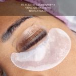 IN PATCH zselés alátét